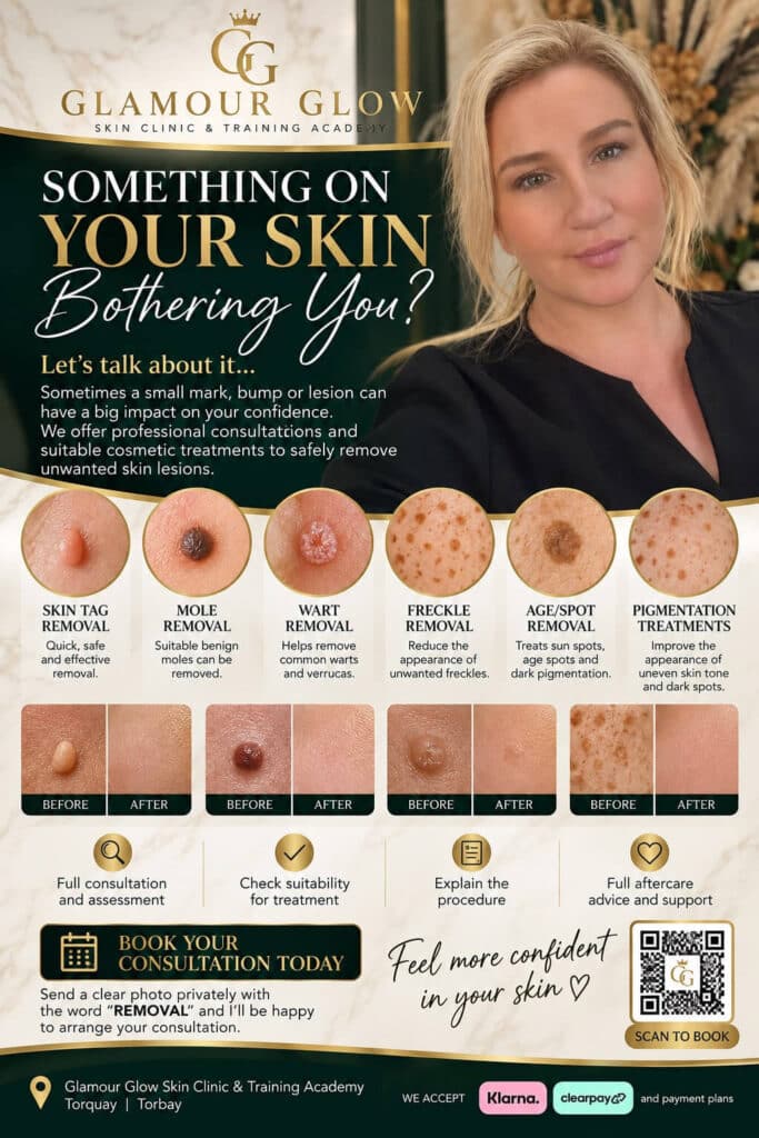 Glamour Glow Skin Clinic & Training Academy skin tag, mole, wart, freckle, age spot and pigmentation removal treatments in Torquay